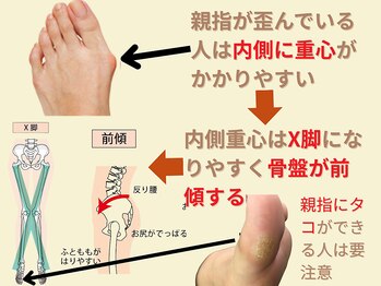 ニコ(niko)/親指にタコがある人は注意！！