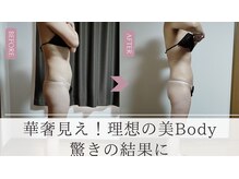 スリール(sourire)の雰囲気（【ウルトランスフォーマー】筋膜リリース痩身/ダイエット/浮腫み）