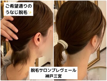プレヴェール 神戸三宮/うなじ脱毛