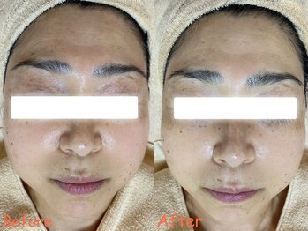 サロンドフルール/ラミネーションピールの施術後