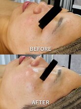 ルーク(Luke)/くすみ／毛穴ケア