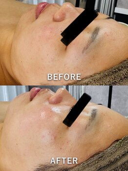 ルーク(Luke)/くすみ／毛穴ケア