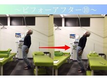 ケアるら整骨院 富里院/ビフォーアフター