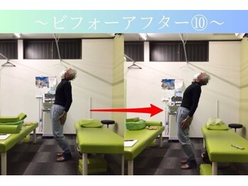 ケアるら整骨院 富里院/ビフォーアフター