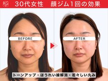 那賀洋子式 顔ジム 大分戸次店/30代女性顔ジム1回の効果