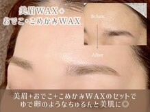 レイ 香川高松店(Rey)/オプション/おでこ・こめかみWAX