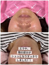 イズビューティー 足利(is Beauty)/レモンボトル