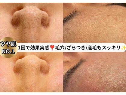ムーロ バイ ミュー(muro. by mieux)の写真