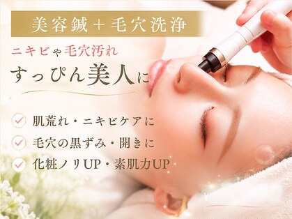 アキュレ(Acure)の写真