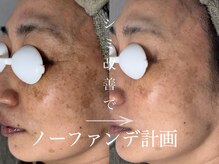 アンドエフ(&F)