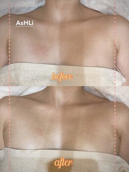 アシュリー 表参道(AsHLi)/お肌もツヤツヤ