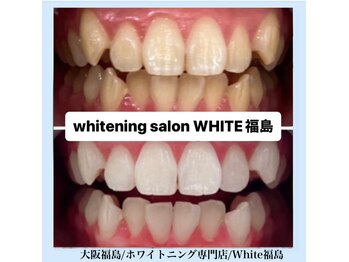 ホワイトニングサロン ホワイト(WHITE)/セルフホワイトニング/大阪/福島