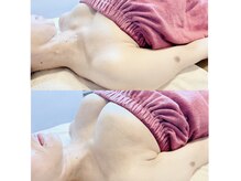 ロココ 浜松店(Rococo)の雰囲気（姿勢から根本改善！マシュマロバストに大変身！張りもアップ！）