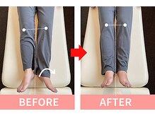 北浦和整体院/産後のがに股や膝痛に