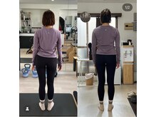 フォルマ(forma)/歪み改善