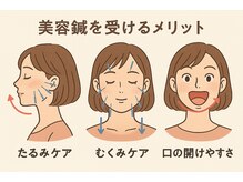 S鍼灸整骨院/美容鍼【メリット】