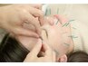 【美容鍼整体コース/セット割】美容鍼＋背骨・骨盤矯正　通常¥11,000→¥8,800