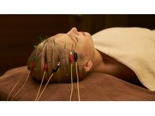 カドモリ 心斎橋(KADOMORI)/【美容鍼/大阪美容鍼/小顔矯正】