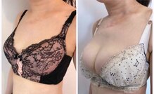 美人バスト 札幌店