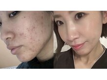 フォーユー 飯能店(Foryou)の雰囲気（セルマン艶玉肌）