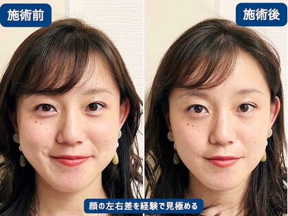 アオヤマ サロン ワイゼット(AOYAMA SALON YZ)の写真