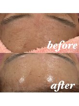 リリーミー(Rily Me)/韓国肌トリートメント