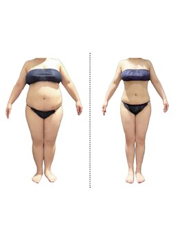 サイズダウンを目指したい