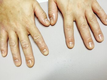 フルール(Fleur)/men'sネイルケア＊