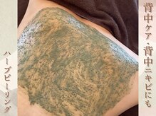 ラナ(LaNa)/背中トラブルもハーブで改善！