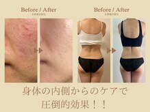 つやや 下北沢(TUYAYA)