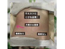 ミライ 福岡筑紫野店(mirai)/なりたいを叶えるボディメイク