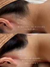 アトリーチェ ベレッツァ(ATTRICE Bellezza)/うなじ脱毛 (シェービング付き)