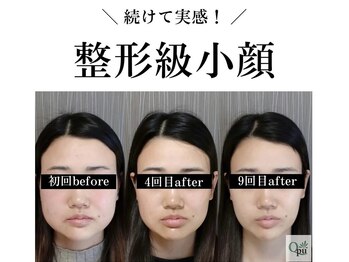 キュープ 富士店(Qpu)の写真/「続けたい!」のお声多数!回数券でお得に通うこともできます◎長く通えるお気に入りサロンにぜひ。