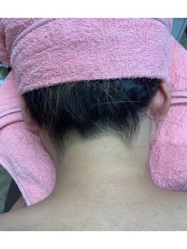 ネイルアンドエステティック デイズ 三好中央店(Days)/ツルツルうなじ！