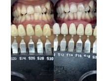 トウキョウスワーズ 池袋店(TOKYO SWRS)/#ホワイトニング #池袋 #渋谷