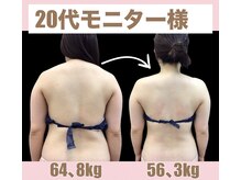 スワン 新栄店(SWAN)/2カ月モニターBefore After 