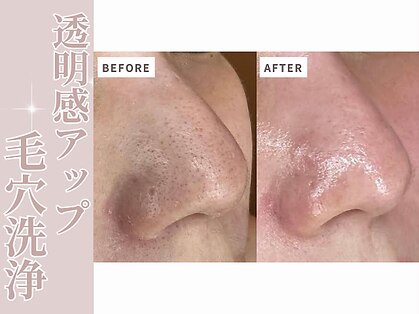 グロー(GROW)の写真