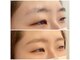 モアビューティ 光町店(MORE BEAUTY)の写真