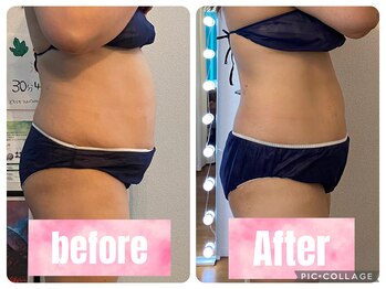 セリーヌ(serene)/キャビ×ラジ×マッサージ