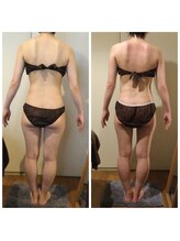 サロン ド ディジェール(Salon de Degel)/3回目ケア下集中/中間測定/痩身