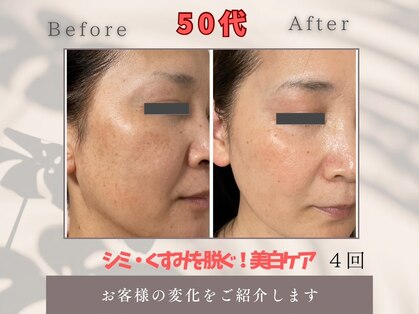 トータルビューティー雅の写真