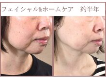 ビィーチェ(VIECE)の雰囲気(サロンケア×ホームケアで最高級のエイジングを)
