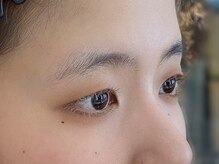 ビューティーガーデン イース/BEFORE