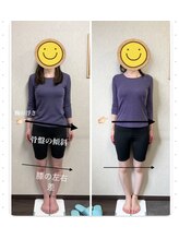 パルフェ(THE Parfait)/美容整骨【全身矯正】