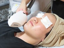 グレイス(GRACE)/顔込み全身脱毛12000円