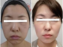 グリッタープラス(glitter plus)/継続が未来の結果を変える