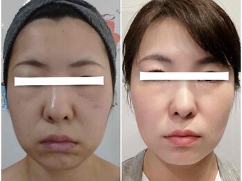 グリッタープラス(glitter plus)/継続が未来の結果を変える