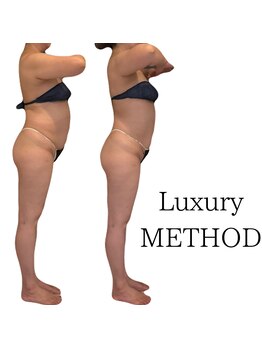 エミナル(EMINALu)/ぽっこりお腹解消