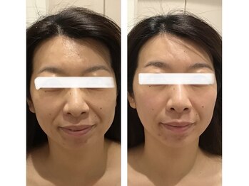 エヌ セレクション(N_selection)/オリジナル美筋小顔マッサージ!!