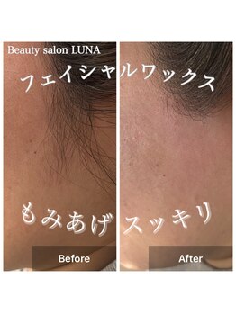 ルナ(LUNA)/フェイシャルWax